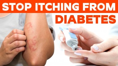 Stop Itching From Diabetes | Orange Health