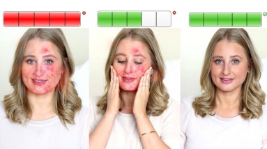 This Natural Paste  Removes the Tan Acne and Pimples | Orange Health