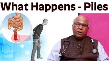 What Happens to Your Body When You Have Piles | Piles causes, and treatments - Dr. CL Venkatarao