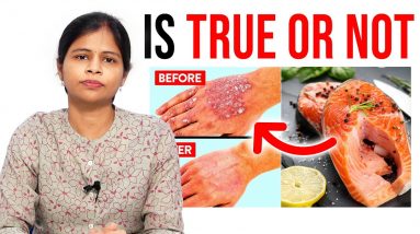 Is Fish Good For Psoriasis - Dr  Swapna Priya | Which Food Good For Psoriasis | Dermatologist