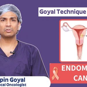 Goyal Technique In Surgery For Endometrial Cancer Treatment - Dr Vipin Goyal
