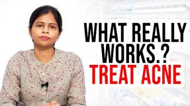 What Really Works For Acne ? - Dr. Swapna Priya | How To Treat Acne