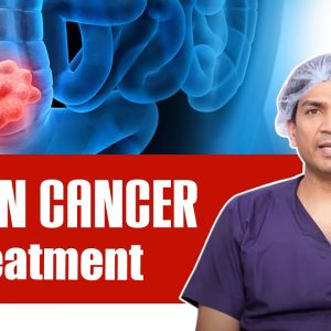 Colon Cancer : Causes , Symptoms and Treatment || Dr.Vipin Goyal Videos