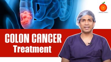 Colon Cancer : Causes , Symptoms and Treatment || Dr.Vipin Goyal Videos