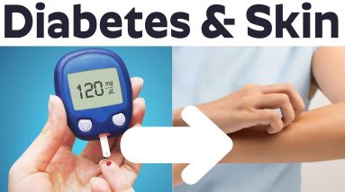 Does Diabetes Cause Itchy Skin.? - Diabetes & Skin Conditions | Dr. Sailaja K Surapaneni