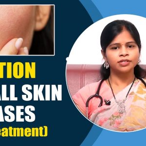 Solution For All Sun Effected Skin Diseases || Dermatologist Dr.Swapna Priya || Orange Health