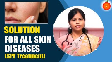 Solution For All Sun Effected Skin Diseases || Dermatologist Dr.Swapna Priya || Orange Health