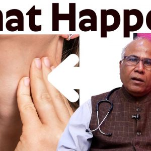 What Happens If You Have Hypothyroidism.? - Dr. CL Venkata Rao