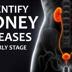 Identify Kidney Diseases in Early Stages || Nephrologist Dr.Anjani Achanta