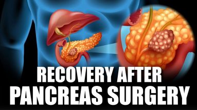 How Long is Recovery After Pancreas Surgery || Orange Health