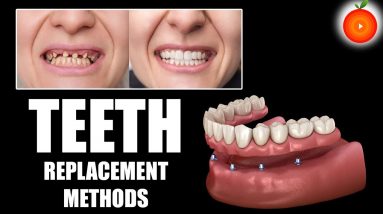 How To Replace Teeth? || Dentist Dr.Vijaya Lakshmi || Orange Health