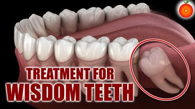 Treatment For WISDOM Teeth || Dental Dr.VijayaLakshmi || Orange Health