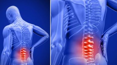 Chronic Low Back Pain: Understanding Lower Back Structures and Treatment Approaches