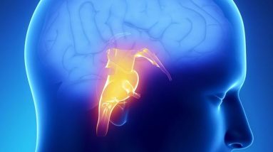 Brain Stroke Symptoms And Treatment | Best Treatment for Brain Stroke