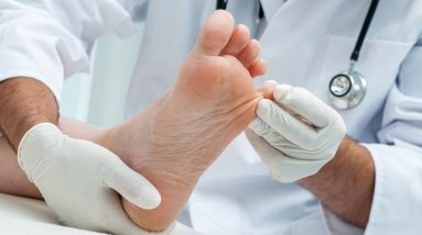 Diabetic Foot: Symptoms, Treatment & Care | Orange Health