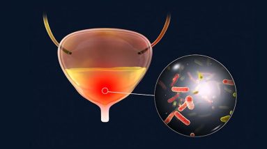 Does UTI Problem Need Hospital Treatment? || UTI Disease, Symptoms, Prevention