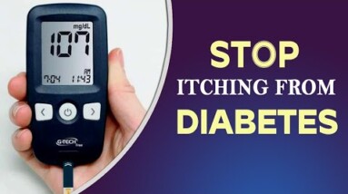 Can diabetes cause itching all over body? | Cure Diabetes Easily | Orange Health