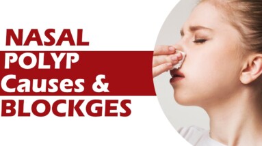 Nasal Polyp Causes And Blockages | DR NEETU MODGIL | ORANGE HEALTH