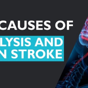 The Causes Of Paralysis And Brain Stroke | DR Dilip Gude | Orange Health