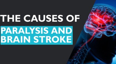 The Causes Of Paralysis And Brain Stroke | DR Dilip Gude | Orange Health