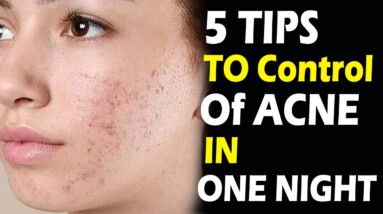 Best Tips To Control Of Pimples In One Night | DR C L VenkatRao  | ORANGE HEALTH