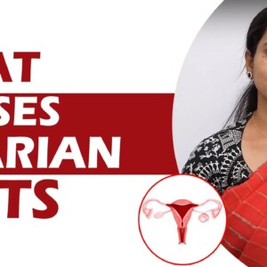 What Causes Ovarian Cysts | DR GITANJALI | ORANGE HEALTH