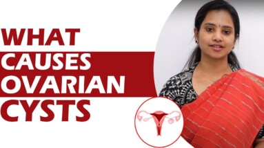 What Causes Ovarian Cysts | DR GITANJALI | ORANGE HEALTH