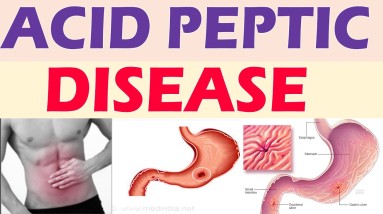 Acid Peptic Disease | Gastric ulcers | DR Dilip Gude | Orange Health
