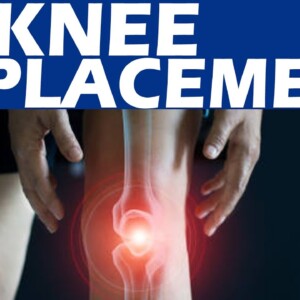 Knee Replacement | DR Vijay Bhaskar |  Orange Health