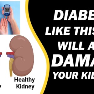 This Diabetes will Damage you Kidneys | Diabetic Nephropathy | Orange Health